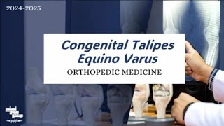 Congenital Talipes Equino Varus  Orthopedic Medicine  Lec 6 [upl. by Etteuqaj]