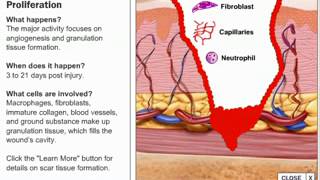 Stages of Wound Healing Process [upl. by Murdoch]