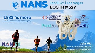 Revolutionizing Outpatient Spine Surgery Technology NANISX amp Experts provide Insights at NANS 2024 [upl. by Letsyrk]