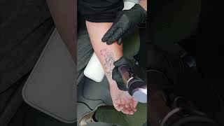 Tattoeage verwijderen met de Pico Derma 4 laser [upl. by Wayne748]