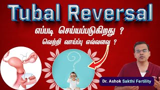 Tubal Ligation Reversal Procedure Success Rates  Tubal Ligation Reversal எப்படி செய்யப்படுகிறது [upl. by Nylirrej118]