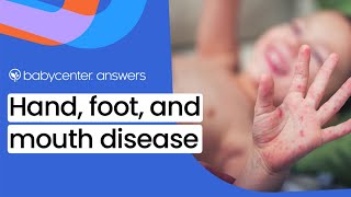 What is hand foot and mouth disease [upl. by Nanaj195]