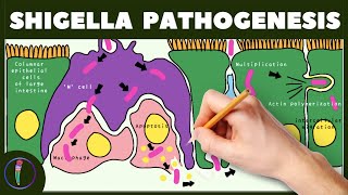 Shigella Pathogenesis Simplified [upl. by Sweet915]