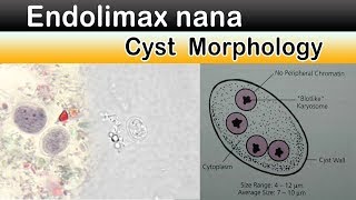 Endolimax nana Cyst Morphology [upl. by Werby325]