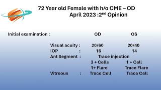 Alendronate induced Cystoid Macular Edema mistakenly treated with multiple intravitreal stero [upl. by Sirc]