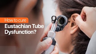 How to cure Eustachian Tube Dysfunction [upl. by Law527]