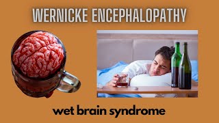 Wernicke Encephalopathy  Wet Brain Syndrome [upl. by Shelton]