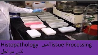 tissue processing in histopathology lab [upl. by Yarg]