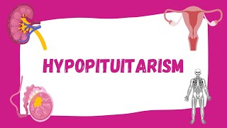 Hypopituitarism  Causes Symptoms Diagnosis Treatment  Endocrinology [upl. by Stevy]