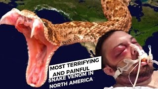 10 Most Terrifying and Painful Venomous Snake Bites In North America 🐍 [upl. by Filipe719]