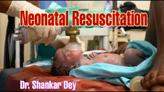 Neonatal Resuscitation  Steps Demonstration  Dr Shankar Dey [upl. by Afital82]