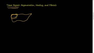 31 Tissue Repair Regeneration Healing Fibrosis [upl. by Eelnodnarb]