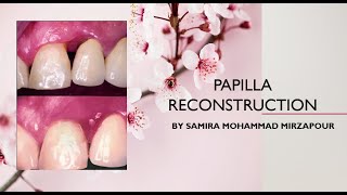 Papilla Reconstruction part 1 of 5 Intro [upl. by Amej984]