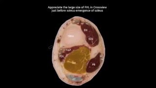 Flexor hallucis longus on Ultrasound [upl. by Ainit]