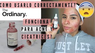 COMO USAR EL EXFOLIANTE THE ORDINARY QUITA ACNÉ CICATRICES  Natural Glam Makeup [upl. by Nolyarg]