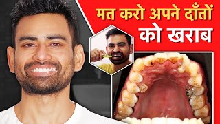 दांतो की Problems से Permanent छुटकारा पाएं Mouth Ulcers Bleeding Gums Bad Breath Cavities [upl. by Llecrup]