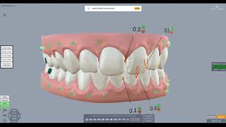 ArchForm Tutorial  How Staging is Calculated and How to Adjust it [upl. by Ecnarwal]