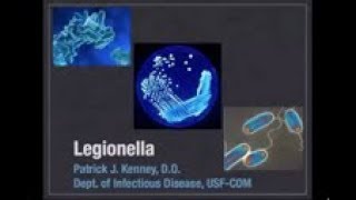 Legionella  Patrick Kenney MD [upl. by Drawdesemaj875]