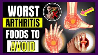 9 WORST Foods for Arthritis amp Inflammation miss healthy [upl. by Cuda]