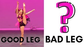 Mackenzies Bad Leg vs Good Leg Surprising [upl. by Htebazil]