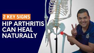 2 Key Signs It Is Possible For Hip Arthritis To Heal Naturally [upl. by Atnek]