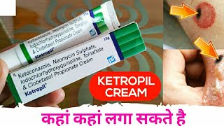 Ketoconazole Neomycin Iodochlorhydroxyquinoline Tolnaftate amp Clobetasol Propionate Cream Ketropil [upl. by Oihsoy]