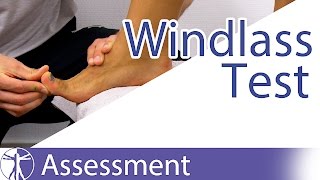 The Windlass Test  Plantar Fasciitis [upl. by Leahcin]