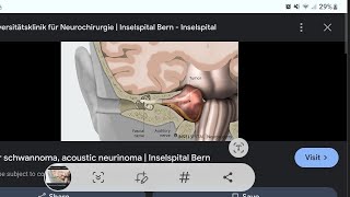 Mystery diagnosis Schwannoma [upl. by Katharine]