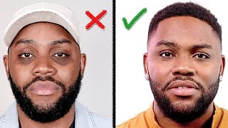 Remove DARK CIRCLES Under Your Eyes How I Did It Mens Skin Care [upl. by Akeim606]