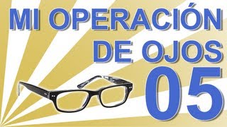 OPERACIÓN DEL SEGUNDO OJO  Experiencia personal operación ojos lentes intraoculares C05 [upl. by Asirahc678]