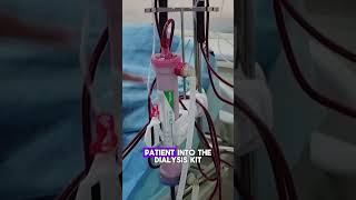 How Hemodialysis Filters Blood  Quick Overviewhemodialysis kidneydialysis dialysistreatment [upl. by Marchall971]