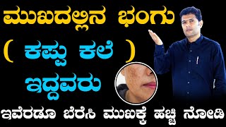 Amazing Tips for Pigmentation in Kannada  pigmentation treatment on face  Bhangu in Kannada [upl. by Jonas927]