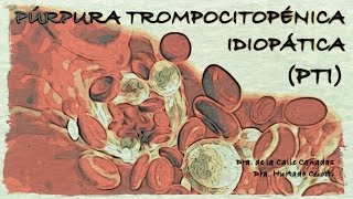 Púrpura trombocitopénica idiopática [upl. by Hsevahb293]