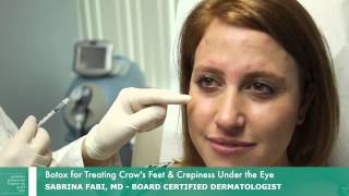 Botox for Crows Feet  Botox Around Eyes  Dr Fabi [upl. by Kano]