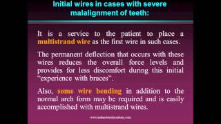 leveling amp aligning in orthodontics  fixed orthodontic courses by Indian dental academy [upl. by Brenn]