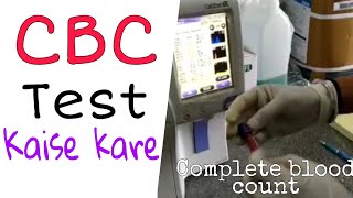 How to performed Cbc test in hindiCbc test kaise kiya jata haidmlt [upl. by Bridgid]