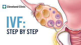 How Does In Vitro Fertilization IVF Work A StepbyStep Explanation [upl. by Sorci179]