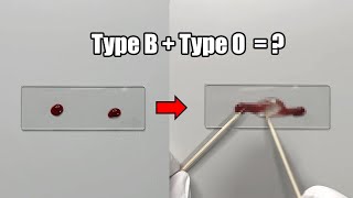 What Happens When Two Different Blood Types are Mixed Together [upl. by Digdirb]