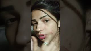 Pimple ki dikkat sandhya singh [upl. by Ydnirb167]