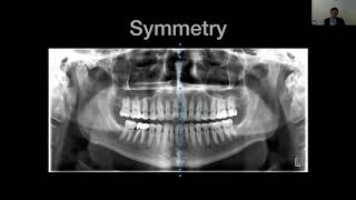 CBCT Interpretation Crash Course for the New User with Dr Peter Green [upl. by Giddings803]