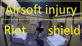 Airsoft injury damn riotshield [upl. by Lawton]