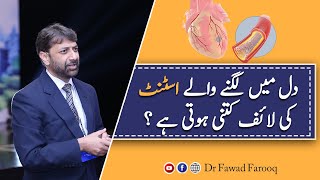 Angioplasty or stent ki life kitni UrduHindi [upl. by Nnaitsirk]