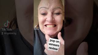 honest review of pop on veneers [upl. by Namsaj846]