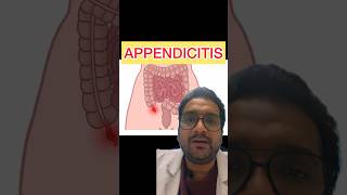 Acute Appendicitis Symptoms and treatment appendicitis appendix [upl. by Ahsenor877]