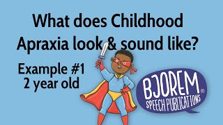 Childhood Apraxia of Speech  Example 1 [upl. by Netsud770]