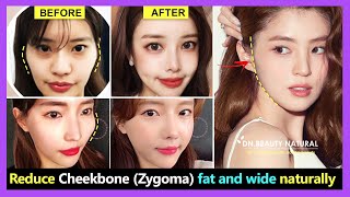 How to reduce Cheekbone fat and wide Zygomatic bone reduction without surgery  Exercise amp Massage [upl. by Shelli47]