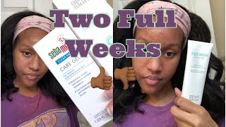 I tried Gladskin Gel to Milk Cleanser and Sebamed Clear Face Care Gel on my Acne  Full review [upl. by Billat]