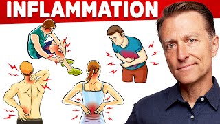 The 1 Best Remedy for Inflammation Autoimmune Gut and Arthritis That You Never Considered [upl. by Alabaster890]