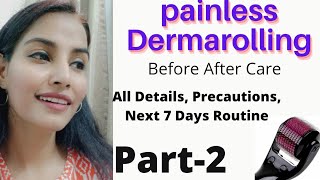 Part2 Painless Dermarolling 15 mm All Details Next 7 Days Routine After Care [upl. by Atekan361]