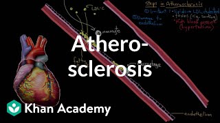 Atherosclerosis  Circulatory System and Disease  NCLEXRN  Khan Academy [upl. by Stamata12]